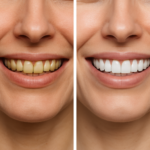 london teeth whitening risks - Before and After: The dramatic visual and functional impact of london teeth whitening risks